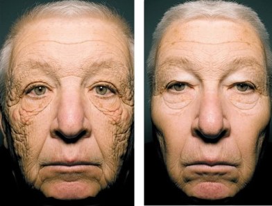 Half this trucker's face was sun damages. Here the real photo was manipulated. The first is the worst case scenario and the other is the best, if he'd used sunscreen daily.